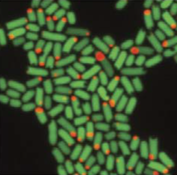 ecoli